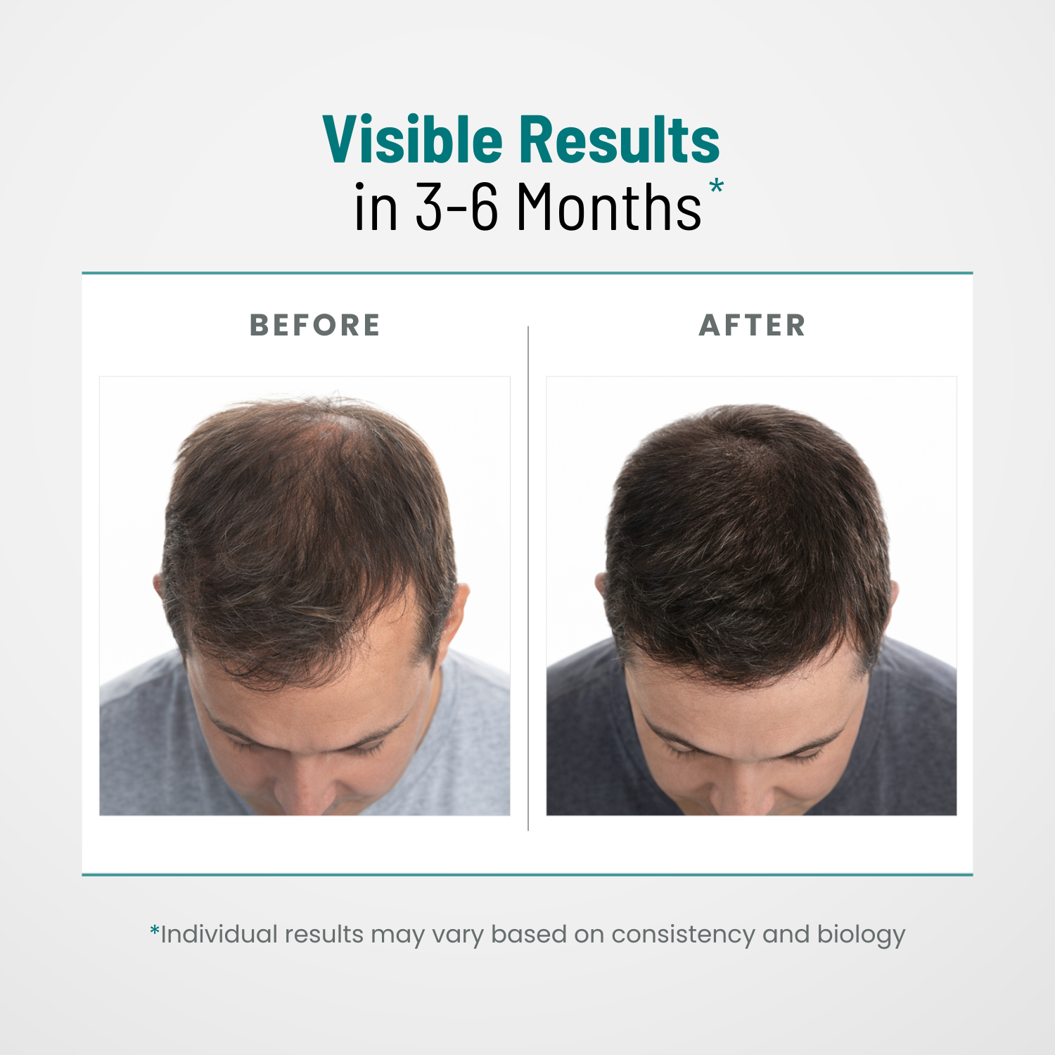 DHT Blocker for Men